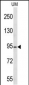 KAT2A Antibody (C-term)